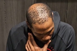 37岁还单身有原因！杜兰特秃顶这么严重 这发量找对象难啊